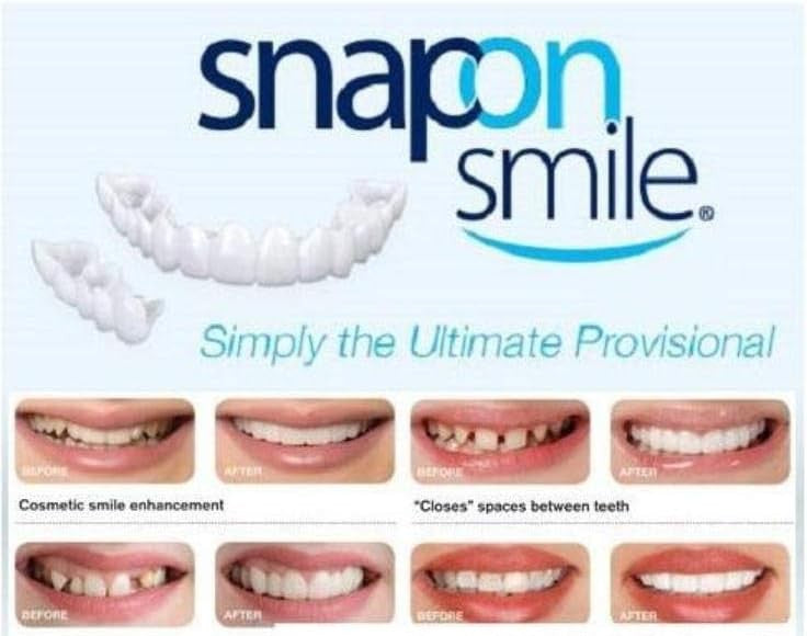 CARRILAS DENTALES- ✨ ¡Transforma Tu Sonrisa al Instante!